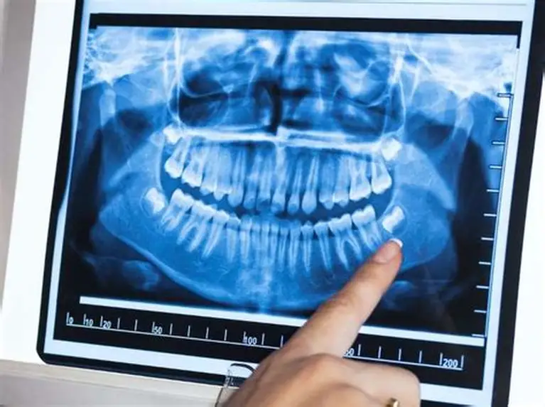 Radiografía Panorámica