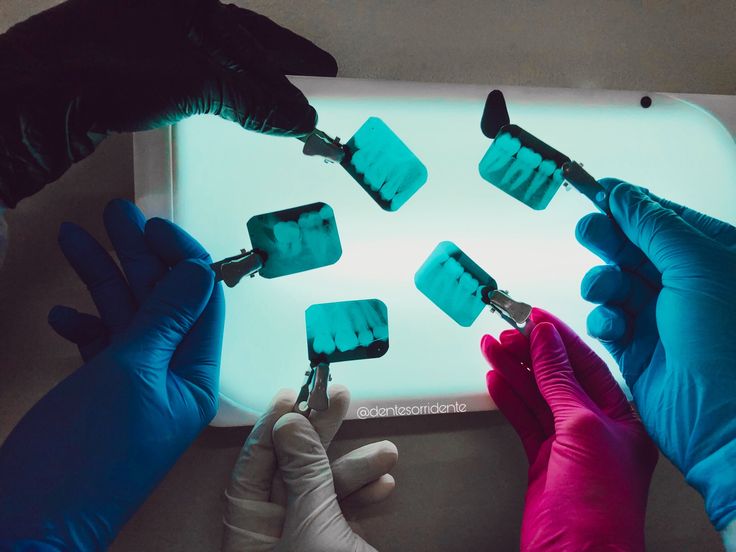 Radiografía Periapical